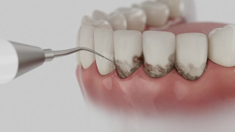 Reliable Dental Implants contractor in Tarrant, AL by Smile Center Dentistry